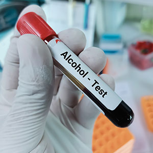 Image highlights the blood tests In Texas.